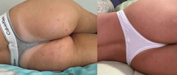 Intimate Bleaching Guide 101: Everything You Need to Know