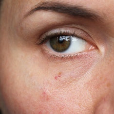 What Are The Best Natural Hair Growth Inhibitors For The Face?