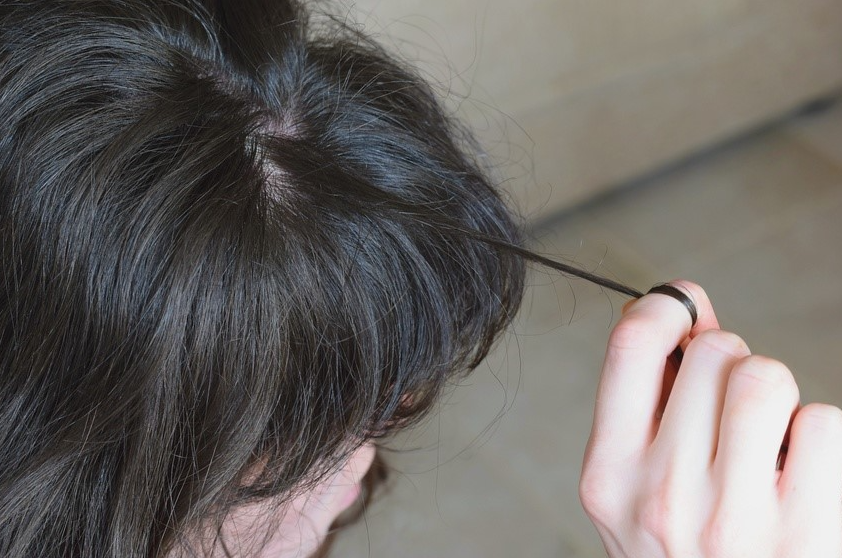 Trichotillomania: A Dermatologist’s Guide to Managing Hair-Pulling Disorder