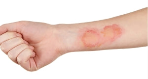 Lux Skin vs. Kenzzi: Which IPL Device Should You Choose?