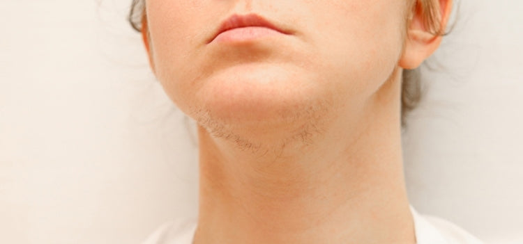 Does IPL Laser Hair Removal Work On Hormonal Hair Growth? (2025 Review)