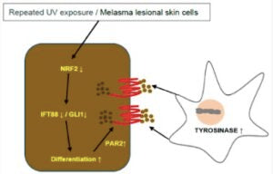 Does LED Phototherapy work? | Melasma Dr Davin Lim