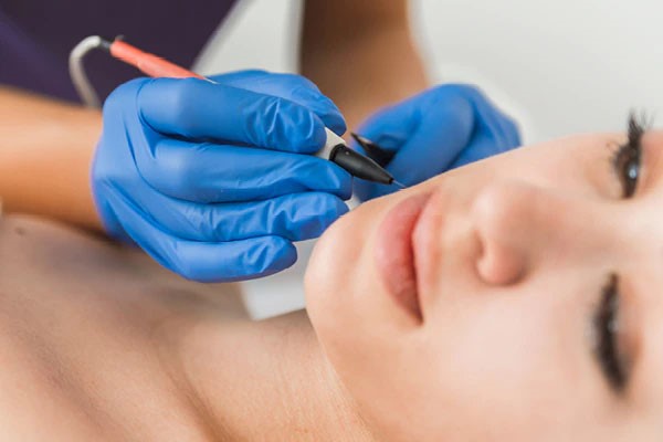 The 5 Best Alternatives to Laser Hair Removal in 2025